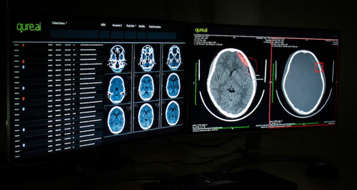 Qure.ai Eyes Up To $60 Mn Funding To Push Its Radiology Diagnosis Play