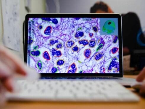 How Technology Is Changing The Outlook Of Breast Cancer Treatment And Diagnosis?